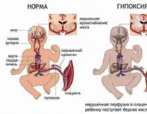Hipoksija u dvogodišnjeg djeteta: simptomi i liječenje