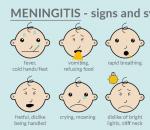 मेनिनजाइटिस - लक्षण और उपचार
