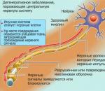 Skleróza multiplex: príznaky, príčiny a príznaky, diagnostika, prevencia