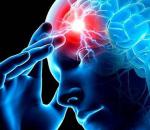 Koja je opasnost od kome nakon moždanog udara?