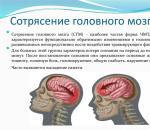 Pillole anti-commozione cerebrale