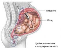 Riesgo de infección por citomegalovirus durante el embarazo