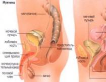 Behandlung von Herpes-Urethritis