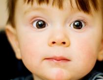 Pupilas dilatadas en un niño.