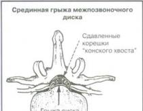 Сэтгэцийн гэмтэл.  Төрлийн.  Юу хийх вэ.  Тархины хаалттай гэмтэл Тархины гэмтлийн эмчилгээ