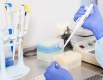 Regras para realização de exames e características de obtenção de resultados de exames de HIV, hepatite, sífilis